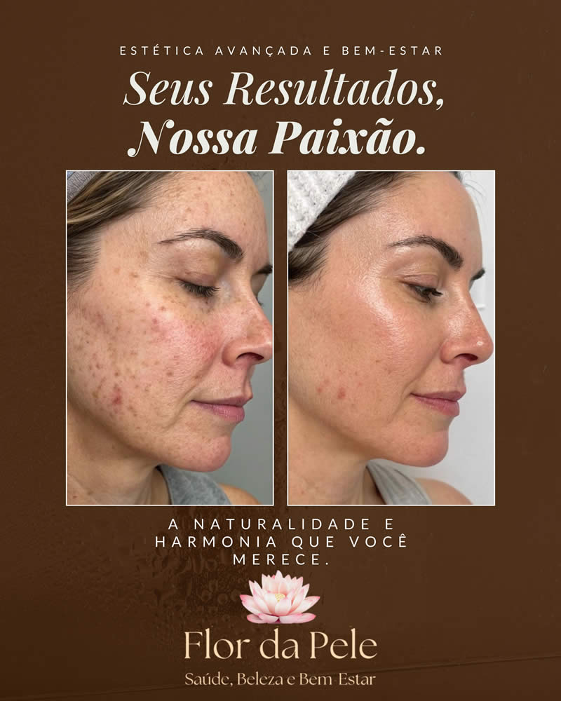 Cópia de Rejuvenescimento_20250905_121206_0000