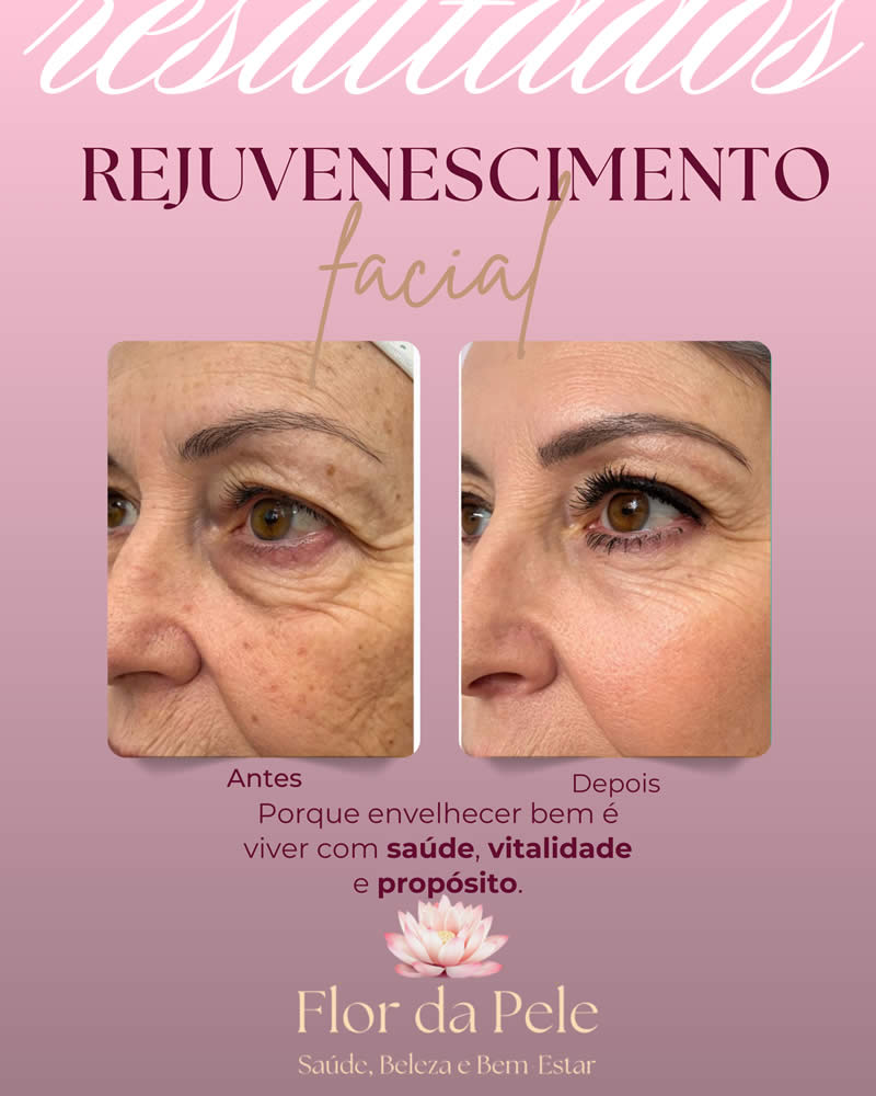 Cópia de Rejuvenescimento_20250905_121246_0000