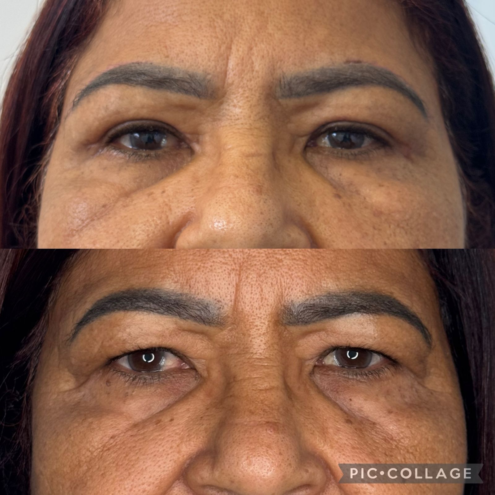 blefaroplastia-vitoria-espirito-santo-consultorio4