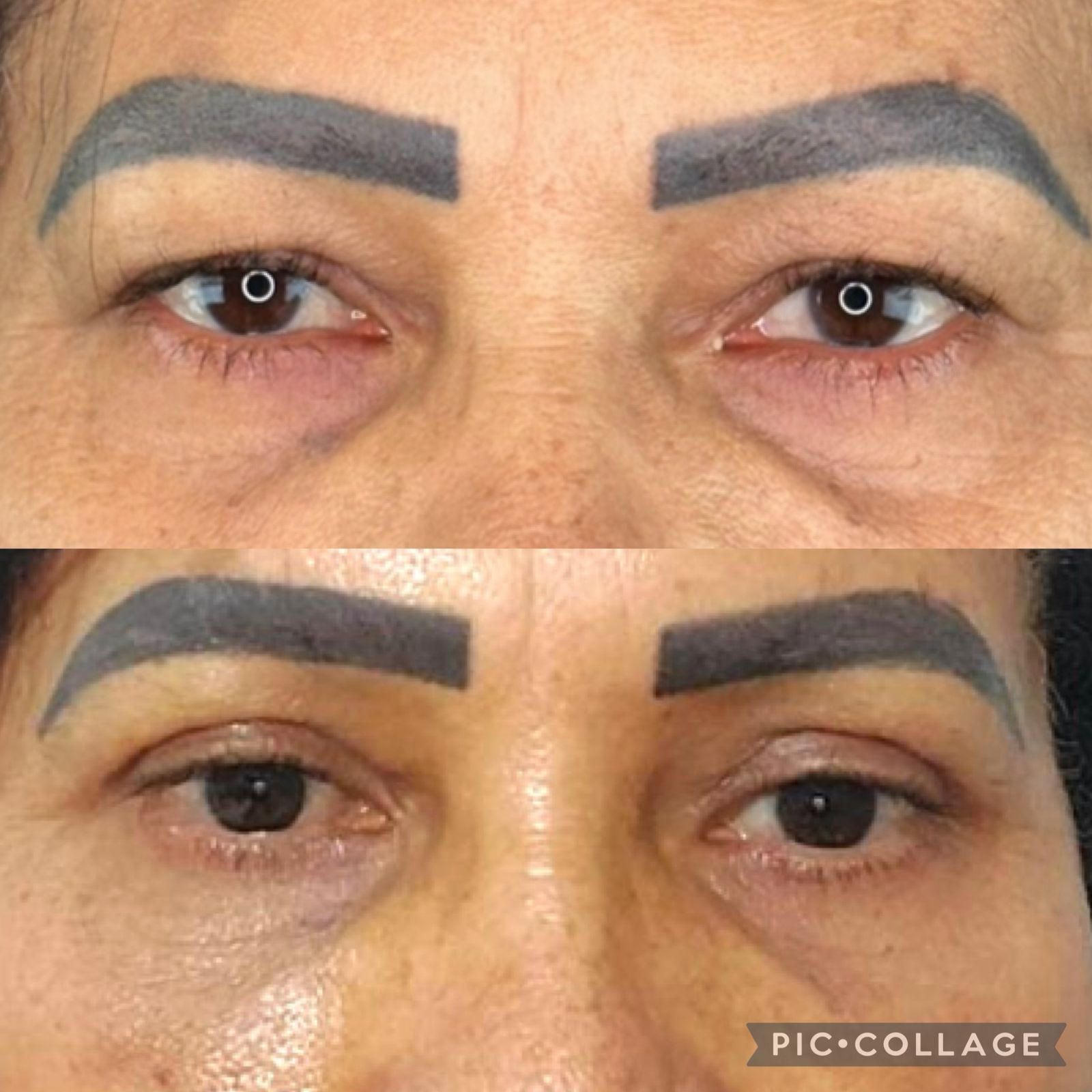 blefaroplastia-vitoria-espirito-santo-consultorio5